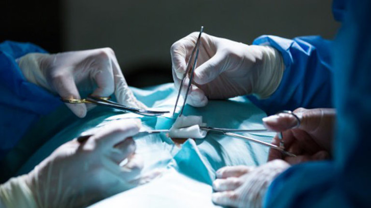 Vascular-Surgery-India