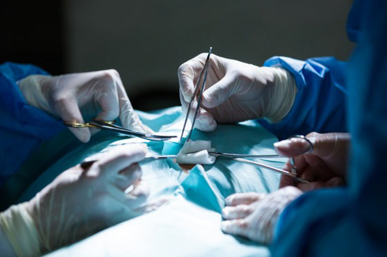 Vascular-Surgery-India